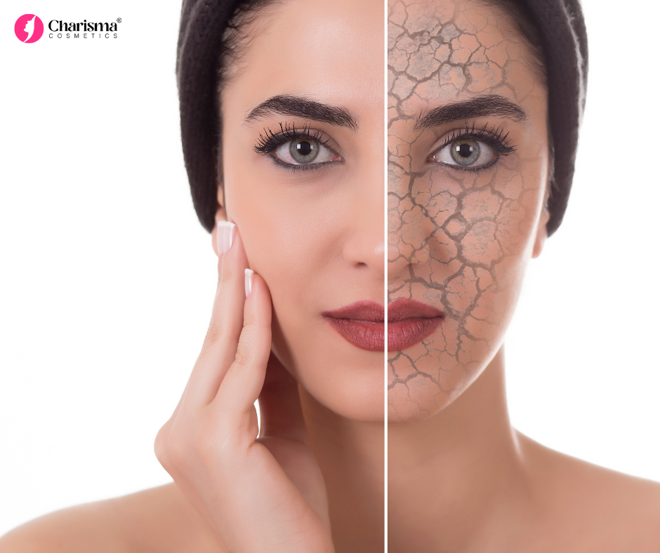 Dry Skin in Winters: How Charisma Cosmetics Can Help You Stay Hydrated and Glowing